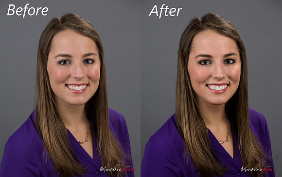 Before and After